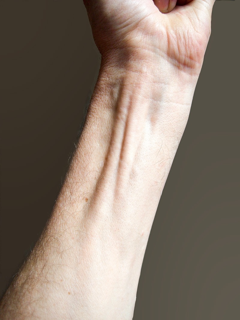 Wrist